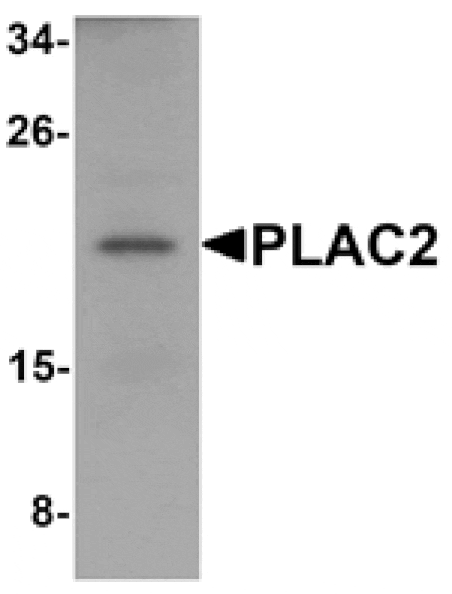 Western blot - PLAC2 Antibody from Signalway Antibody (25204) - Antibodies.com