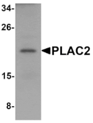 Western blot - PLAC2 Antibody from Signalway Antibody (25204) - Antibodies.com