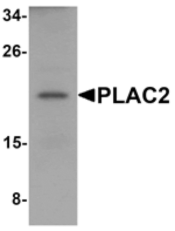Western blot - PLAC2 Antibody from Signalway Antibody (25204) - Antibodies.com