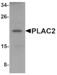 Western blot - PLAC2 Antibody from Signalway Antibody (25204) - Antibodies.com