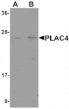 Western blot - PLAC4 Antibody from Signalway Antibody (25206) - Antibodies.com