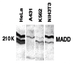 Western blot analysis of MADD in whole cell lysates from the indicated cell lines with MADD antibody at 1: 250 dilution.