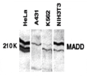 Western blot - MADD Antibody from Signalway Antibody (24025) - Antibodies.com