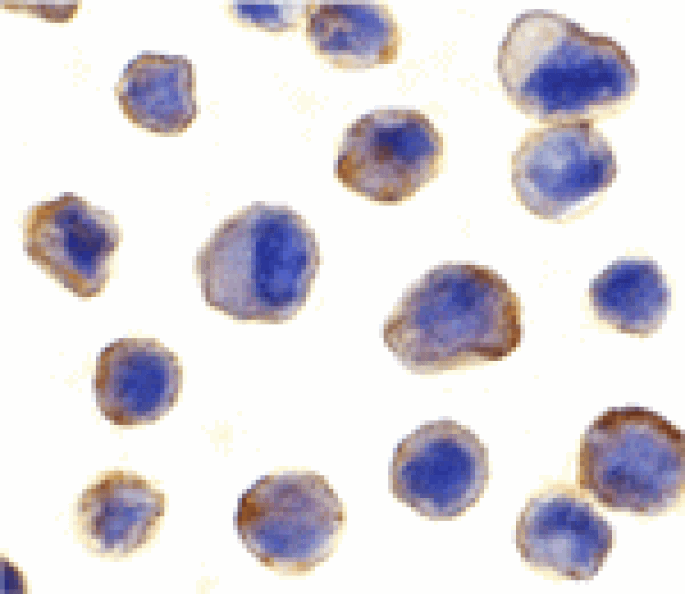 Immunocytochemistry - MADD Antibody from Signalway Antibody (24025) - Antibodies.com