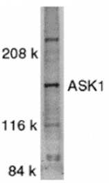 Western blot - ASK1 Antibody from Signalway Antibody (24026) - Antibodies.com