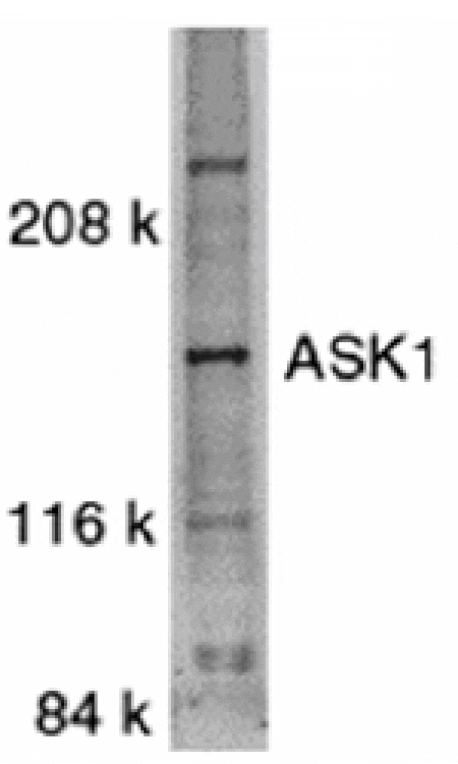 Western blot - ASK1 Antibody from Signalway Antibody (24026) - Antibodies.com