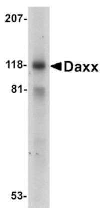 Western blot - Daxx Antibody from Signalway Antibody (24031) - Antibodies.com