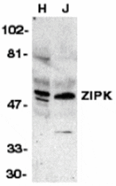 Western blot - ZIPK Antibody from Signalway Antibody (24048) - Antibodies.com
