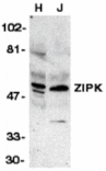 Western blot - ZIPK Antibody from Signalway Antibody (24048) - Antibodies.com