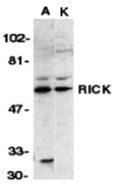Western blot - RICK Antibody from Signalway Antibody (24051) - Antibodies.com