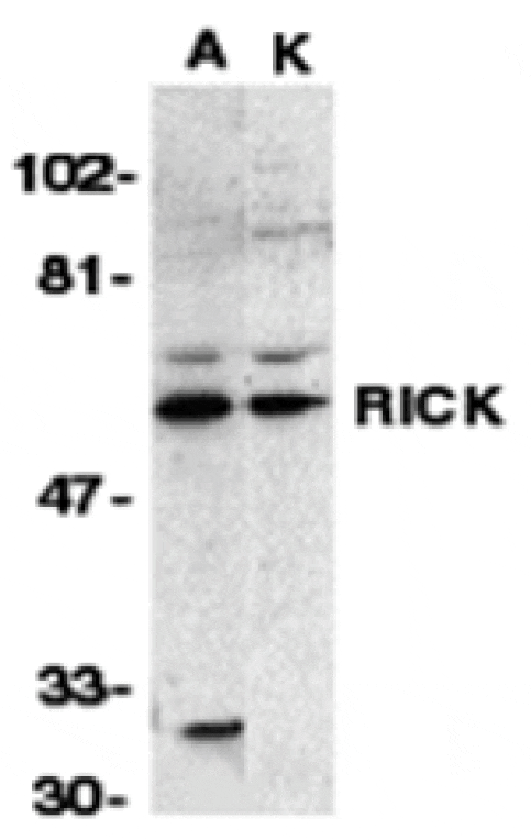 Western blot - RICK Antibody from Signalway Antibody (24051) - Antibodies.com