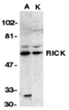 Western blot - RICK Antibody from Signalway Antibody (24051) - Antibodies.com