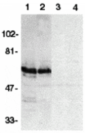 Western blot - SODD Antibody from Signalway Antibody (24072) - Antibodies.com