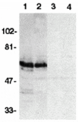 Western blot - SODD Antibody from Signalway Antibody (24072) - Antibodies.com