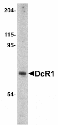 Western blot - DcR1 Antibody from Signalway Antibody (24079) - Antibodies.com