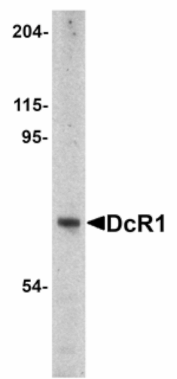 Western blot - DcR1 Antibody from Signalway Antibody (24079) - Antibodies.com