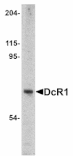 Western blot - DcR1 Antibody from Signalway Antibody (24079) - Antibodies.com