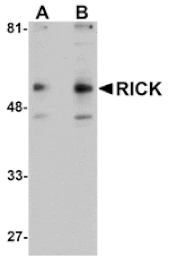 Western blot - RICK Antibody from Signalway Antibody (24080) - Antibodies.com