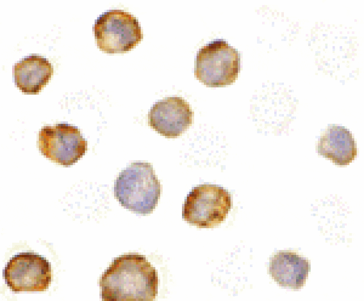 Immunocytochemistry - RICK Antibody from Signalway Antibody (24080) - Antibodies.com