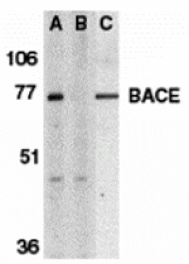 Western blot - BACE Antibody from Signalway Antibody (24100) - Antibodies.com