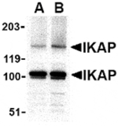 Western blot - IKAP Antibody from Signalway Antibody (24123) - Antibodies.com