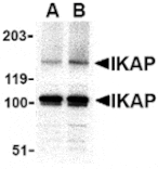 Western blot - IKAP Antibody from Signalway Antibody (24123) - Antibodies.com