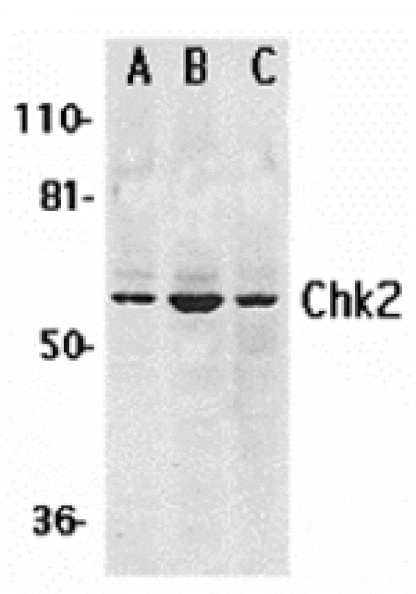 Western blot - Chk2 Antibody from Signalway Antibody (24130) - Antibodies.com