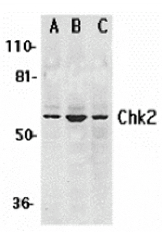 Western blot - Chk2 Antibody from Signalway Antibody (24130) - Antibodies.com