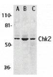 Western blot - Chk2 Antibody from Signalway Antibody (24130) - Antibodies.com