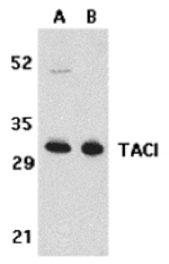 Western blot - TACI Antibody from Signalway Antibody (24131) - Antibodies.com
