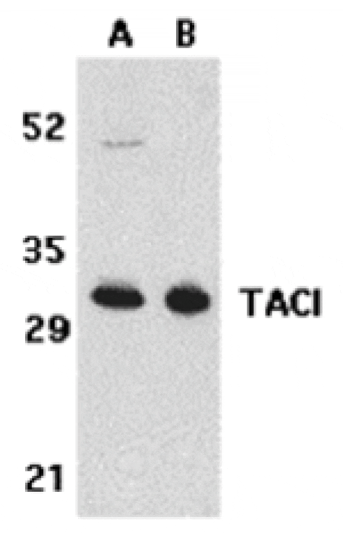 Western blot - TACI Antibody from Signalway Antibody (24131) - Antibodies.com