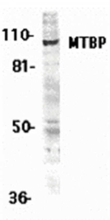 Western blot - MTBP Antibody from Signalway Antibody (24140) - Antibodies.com