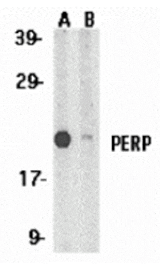 Western blot - PERP Antibody from Signalway Antibody (24142) - Antibodies.com