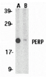 Western blot - PERP Antibody from Signalway Antibody (24142) - Antibodies.com