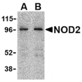 Western blot - NOD2 Antibody from Signalway Antibody (24159) - Antibodies.com