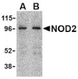 Western blot - NOD2 Antibody from Signalway Antibody (24159) - Antibodies.com