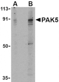 Western blot - PAK5 Antibody from Signalway Antibody (24182) - Antibodies.com