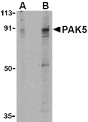 Western blot - PAK5 Antibody from Signalway Antibody (24182) - Antibodies.com