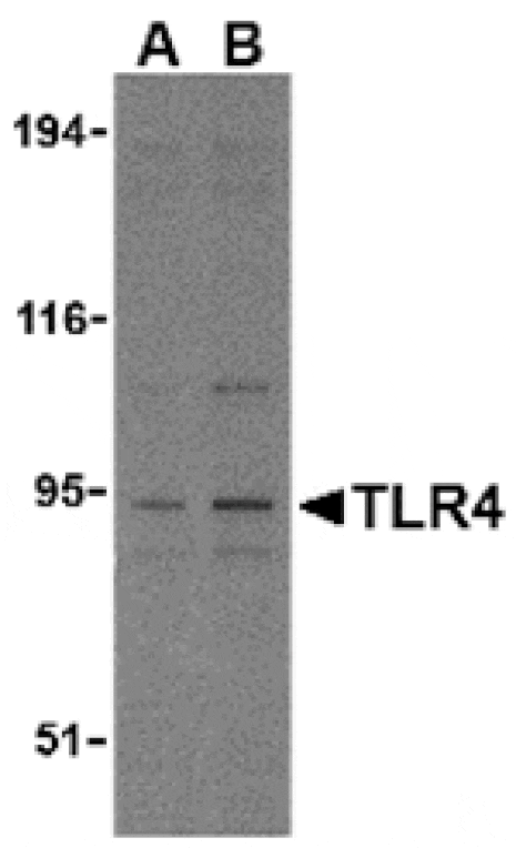 Western blot - TLR4 Antibody from Signalway Antibody (24194) - Antibodies.com