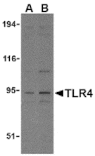 Western blot - TLR4 Antibody from Signalway Antibody (24194) - Antibodies.com