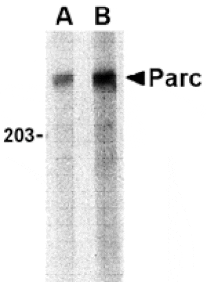 Western blot - PARC Antibody from Signalway Antibody (24204) - Antibodies.com