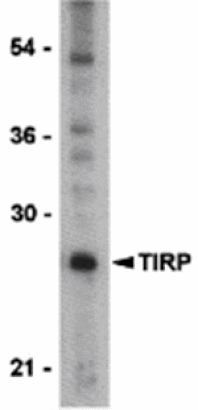 Western blot - TIRP Antibody from Signalway Antibody (24212) - Antibodies.com