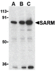 Western blot - SARM Antibody from Signalway Antibody (24236) - Antibodies.com