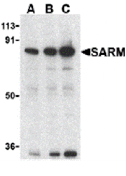 Western blot - SARM Antibody from Signalway Antibody (24236) - Antibodies.com