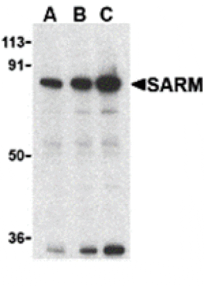 Western blot - SARM Antibody from Signalway Antibody (24236) - Antibodies.com