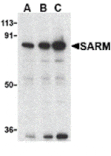 Western blot - SARM Antibody from Signalway Antibody (24236) - Antibodies.com