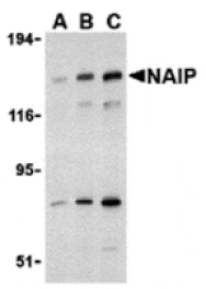 Western blot - NAIP Antibody from Signalway Antibody (24240) - Antibodies.com