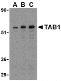 Western blot - TAB1 Antibody from Signalway Antibody (24262) - Antibodies.com