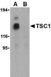 Western blot - TSC1 Antibody from Signalway Antibody (24309) - Antibodies.com