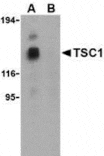 Western blot - TSC1 Antibody from Signalway Antibody (24309) - Antibodies.com